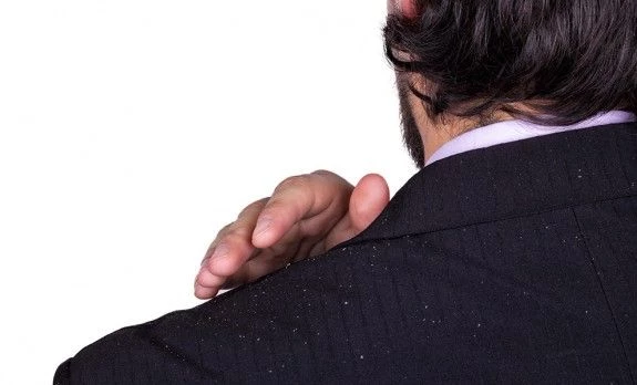 Διώξε την πιτυρίδα στο λεπτό με αυτήν τη συνταγή!